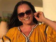 Экс-директор Софии Ротару рассказала о неудачной пластической операции певицы