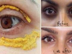 Golden mask for the skin around the eyes! Minus 10 years in 5 minutes