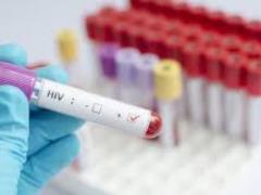 Медики винайшли ліки, переважна розвиток ВІЛ