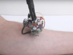 Разработан робот, который шагает по коже, изучая ее состояние