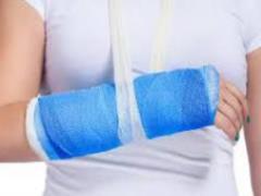 Стало відомо, як тренувати зламану руку