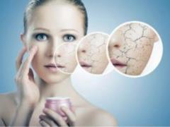 Take care of your skin during the cold season