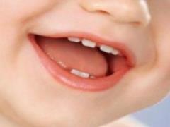 6 myths about baby teeth