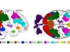 Scientists have created the first accurate map of the brain