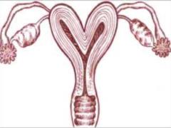 Two-horned uterus: what is it