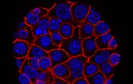 Scientists have learned to predict the appearance of cancer