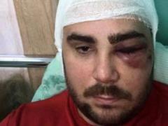 В Запорожье подстрелили одного из лидеров движения  евробляхеров 