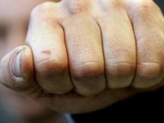 В Кривом роге неизвестные избили депутата
