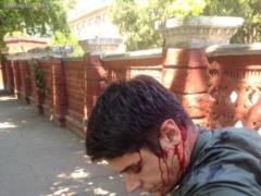 Віталій Устименко: Одного з організаторів нападу на мене випустили з СІЗО