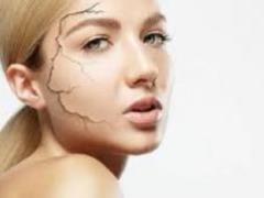 5 способов быстро избавиться от сухой и шелушащейся кожи