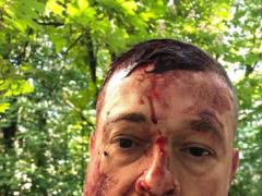 В Харькове жестоко избили активиста  Нацкорпусу  (фото 18+)