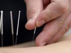 Иглоукалывание и эндорфины снизили тягу к алкоголю у крыс