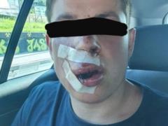 В Польше жестоко избили студента из Украины