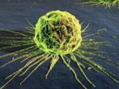 A lifestyle that protects against cancer - expert advice