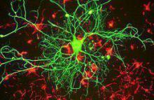 Invisible problems of multiple sclerosis