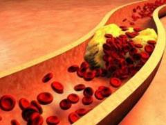 At what age do you need to start monitoring cholesterol