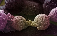 Mutations causing lung cancer found