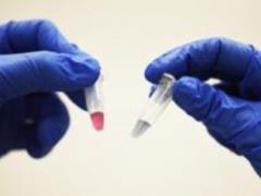 Diagnosis at home: 6 simple tests will reveal hidden diseases