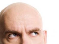 Experts have found out which of the men has a greater risk of balding with age
