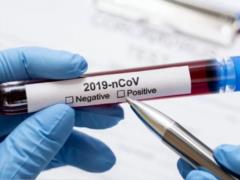 Количество подтвержденных случаев COVID-19 в Украине за сутки выросло с 16 до 21, поражены 6 областей, 3 смерти