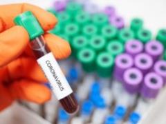 Уже очень скоро: стало известно, когда в Украине будет пик заболеваний на коронавирус