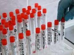 A man faces 15 years in prison for violating quarantine: he infected 11 people with coronavirus