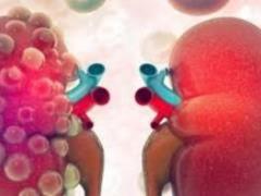 The severity of Alport syndrome can be predicted by the genotype of the protein that causes it