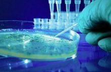 Why is amniocentesis performed?
