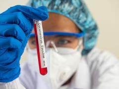 Испытания французской вакцины от коронавируса на человеке начнутся летом