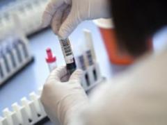 Уже более 6000 зараженных на коронавирус: в Украине статистика продолжает расти