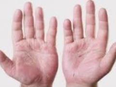 Vitamins in tablets will not work: what is during vitamin deficiency
