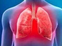 Doctor: how to avoid lung complications with COVID-19