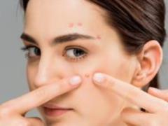 A new acne remedy