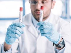Ляшко: в конце июля или в августе ситуация с заболеваемостью COVID-19 в стране станет намного легче