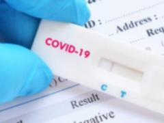 Scientists from Singapore named new dates for the end of the coronavirus pandemic in the world