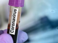 За весь период пандемии в Госпогранслужбе выявлено 20 случаев заболевания коронавирусом