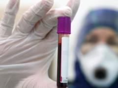 Moscow Mayor s Office has purchased Dutch tests for antibodies to COVID-19. They turned out to be Chinese