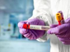 В Минздраве рассказали, кого бесплатно будут тестировать на COVID-19