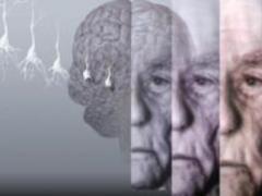 Scientists have discovered which foods contribute to the development of Alzheimer s