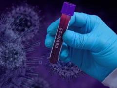 Главный вирусолог Австралии: SARS-CoV-2 идеально совместим с человеком