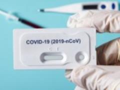 Коронавирус в Украине: количество новых случаев существенно уменьшилось