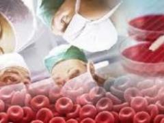 How lifestyle and cancer are related: scientists explain