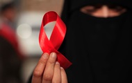 Scientists have reported a new cure for HIV