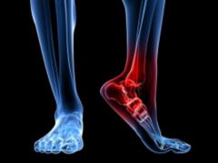 Scientists from India have developed an innovative drug for the treatment of arthrosis