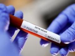 Коронавирус в Украине: количество случаев заражения перевалило за 55 000