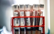 В Британии выделили шесть форм COVID-19
