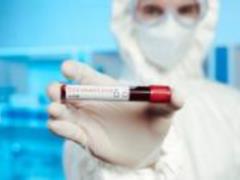 15 regions of Ukraine are not ready to weaken quarantine