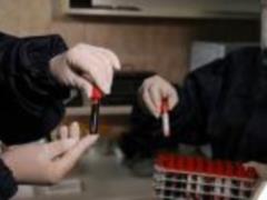 In Odessa and Zhytomyr regions, cases of re-infection with coronavirus were recorded