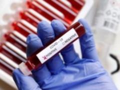 Коронавирусный рекорд в Украине: более 2700 больных, данные за 4 сентября