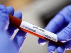 Ministry of Health conducts record number of coronavirus tests per day